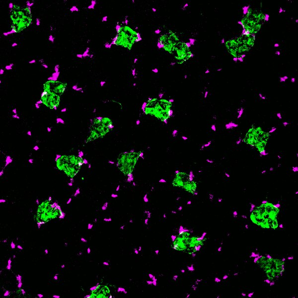 Immunofluorescent image of mouse muscle cryosections labeled with DSHB antibody 6H1-Xi/Rabbit against Myosin heavy chain, Type IIX (green). Image Credit: Yang-Nim Park, DSHB